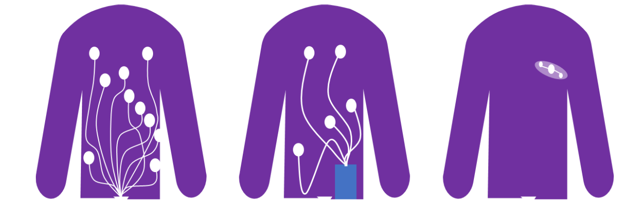 Typical applicaiton of different methods of cardiac monitoring