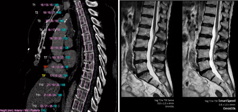 imaging outcomes